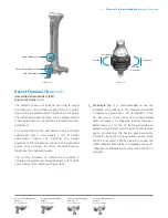 Preview for 15 page of Zimmer Biomet Persona Manual