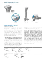 Preview for 16 page of Zimmer Biomet Persona Manual