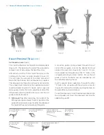 Preview for 18 page of Zimmer Biomet Persona Manual