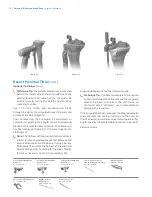 Preview for 20 page of Zimmer Biomet Persona Manual