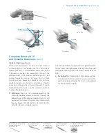 Preview for 25 page of Zimmer Biomet Persona Manual