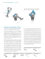 Preview for 26 page of Zimmer Biomet Persona Manual