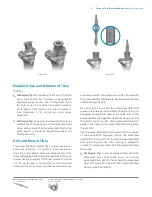 Preview for 27 page of Zimmer Biomet Persona Manual