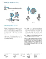 Preview for 28 page of Zimmer Biomet Persona Manual