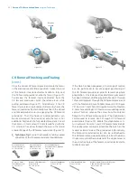 Preview for 34 page of Zimmer Biomet Persona Manual