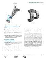 Preview for 35 page of Zimmer Biomet Persona Manual