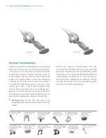 Preview for 40 page of Zimmer Biomet Persona Manual