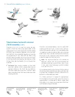 Preview for 42 page of Zimmer Biomet Persona Manual