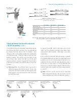 Preview for 43 page of Zimmer Biomet Persona Manual