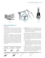 Preview for 47 page of Zimmer Biomet Persona Manual