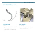 Preview for 8 page of Zimmer Biomet Universal Clamp Surgical Technique Manual