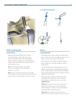 Preview for 9 page of Zimmer Biomet Universal Clamp Surgical Technique Manual