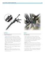 Preview for 13 page of Zimmer Biomet Universal Clamp Surgical Technique Manual