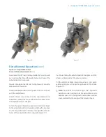 Preview for 11 page of Zimmer Biomet Vanguard  ID Total Knee Surgical Technique