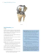 Preview for 22 page of Zimmer Biomet Vanguard  ID Total Knee Surgical Technique