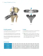 Preview for 24 page of Zimmer Biomet Vanguard  ID Total Knee Surgical Technique