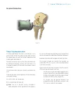 Preview for 29 page of Zimmer Biomet Vanguard  ID Total Knee Surgical Technique