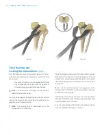 Preview for 34 page of Zimmer Biomet Vanguard  ID Total Knee Surgical Technique