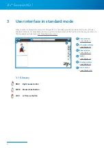 Preview for 16 page of Zimmer Biomet Zfx EvolutionNEXT Manual