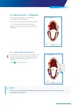 Preview for 23 page of Zimmer Biomet Zfx EvolutionNEXT Manual