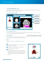 Preview for 24 page of Zimmer Biomet Zfx EvolutionNEXT Manual