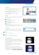 Preview for 25 page of Zimmer Biomet Zfx EvolutionNEXT Manual