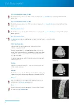 Preview for 26 page of Zimmer Biomet Zfx EvolutionNEXT Manual