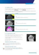 Preview for 27 page of Zimmer Biomet Zfx EvolutionNEXT Manual