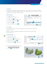 Preview for 43 page of Zimmer Biomet Zfx EvolutionNEXT Manual