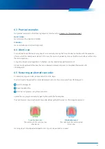 Preview for 49 page of Zimmer Biomet Zfx EvolutionNEXT Manual