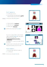 Preview for 57 page of Zimmer Biomet Zfx EvolutionNEXT Manual