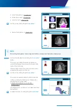 Preview for 59 page of Zimmer Biomet Zfx EvolutionNEXT Manual