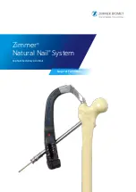 Preview for 1 page of Zimmer Biomet Zimmer Natural Nail Manual