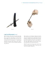 Preview for 19 page of Zimmer Biomet Zimmer Natural Nail Manual