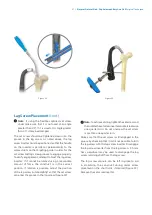 Preview for 23 page of Zimmer Biomet Zimmer Natural Nail Manual