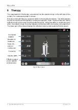 Preview for 31 page of Zimmer MicroPro Instructions For Use Manual