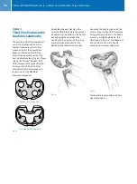 Предварительный просмотр 36 страницы Zimmer MIS Multi-Reference Surgical Technique