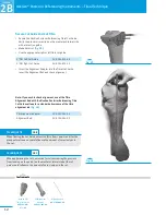 Preview for 16 page of Zimmer NexGen Surgical Techniques