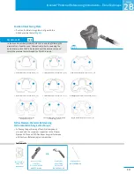 Preview for 17 page of Zimmer NexGen Surgical Techniques