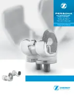 Zimmer Persona Trabecular Metal Femoral Component Surgical Technique preview