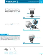 Предварительный просмотр 7 страницы Zimmer Persona Trabecular Metal Femoral Component Surgical Technique