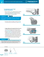 Предварительный просмотр 12 страницы Zimmer Persona Trabecular Metal Femoral Component Surgical Technique