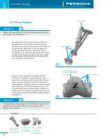 Предварительный просмотр 14 страницы Zimmer Persona Trabecular Metal Femoral Component Surgical Technique