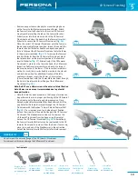 Предварительный просмотр 15 страницы Zimmer Persona Trabecular Metal Femoral Component Surgical Technique