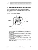 Предварительный просмотр 47 страницы ZOE PPM3 User Manual