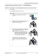 Preview for 43 page of ZOLL aed pro Operator'S Manual