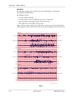 Preview for 60 page of ZOLL aed pro Operator'S Manual