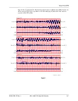 Preview for 61 page of ZOLL aed pro Operator'S Manual