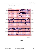 Preview for 63 page of ZOLL aed pro Operator'S Manual