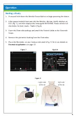 Preview for 11 page of ZOLL Cardiac Monitor User Manual